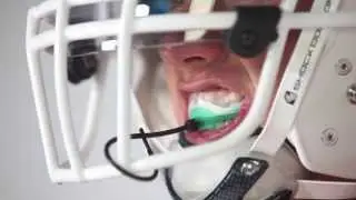 ULTRA 2STC MOUTHGUARD