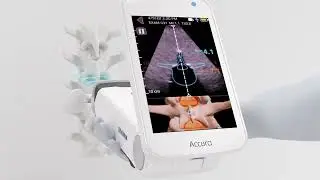 How to Operate Accuro [7 Tips]