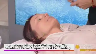 International Mind-Body Wellness Day: The Benefits of Facial Acupuncture & Ear Seeding