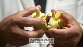 Cox Decompression of the Low Back