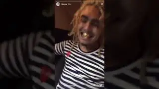Lil Pump Gold Teeth or grill?