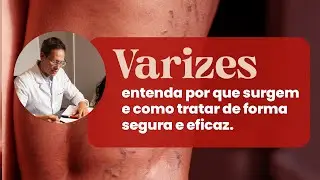 Varizes: entenda por que surgem e como tratar de forma segura e eficaz.