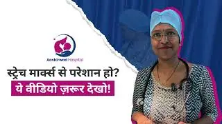 Stretch Marks हटाना अब Possible है! बिना दर्द के इलाज जानिए! | Say Bye to Stretch Marks Naturally