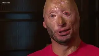 Wounded hero healing through humor