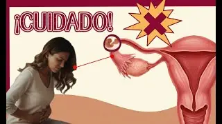 🤰 EMBARAZO ECTÓPICO Estos son los síntomas de alerta