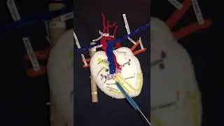 electrical conduction system & blood circulation in the heart