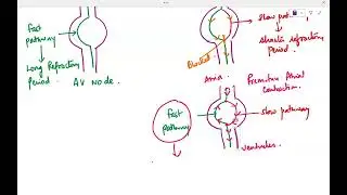 AVNRT basics