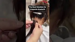 Undetectable hair patch!!! #hairextensions #hair #hairtok #hairstyle