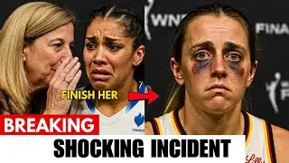 Lexie Hull&rsquo;s Black Eye Incident: The Truth They Don&rsquo;t Want You To Hear!