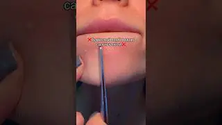 от черных точек 🤌🏻Мою энзимку можно найти на ВБ по запросу &laquo;Энзимка Seauty&raquo; или по арту #WW224169