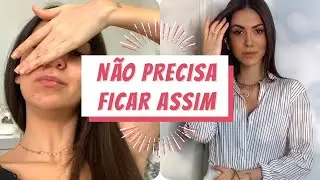 PAPO MAGRINHAS: Tome a VACINA da Autoestima | Mi Garcia