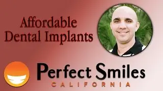 Affordable Chula Vista CA Dental Implants| Chula Vista CA Implant Dentist|Dr. David Garate