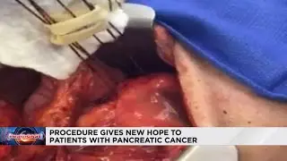 IRE procedure provides hope for patients with pancreatic cancer