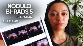 Suspeita de câncer de mama aos 33 anos, como descobri, classificação Bi-Rads 5, autoexame da mama