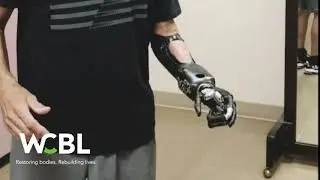 Myoelectric Upper Extremity Prosthetic Device