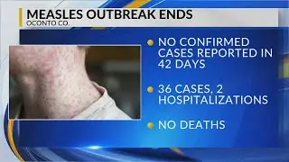 DHS: Measles outbreak ends in Oconto County with 36 confirmed cases