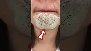 Mascarilla facial para puntos negros y poros abiertos | T&eacute; verde en barra Guatemala