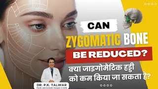 Can Zygomatic Bone be Reduced? Cheekbone Reduction Surgery in Delhi | Dr. PK Talwar