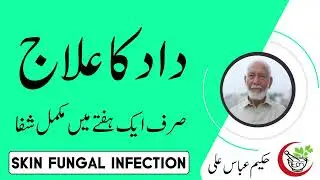 Daad Dadri Ka Ilaj || Ringworm Removal   Skin Fungal Infection By Hakeem Abbas Ali #hakeemabbasali