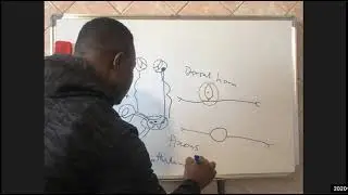 KROK 1 FEBRUARY 2020 Question 1 - 20 Detailed Explanations