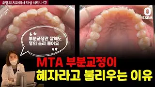 MTA 부분 교정을 왜 혜자라고 하는가? 앞니 6개만 치아교정 (오쌤 강의 中)