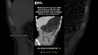 what is your diagnosis?? #healthchannel #medicaldoctor #doctor #doctorslife #doctorslife #document
