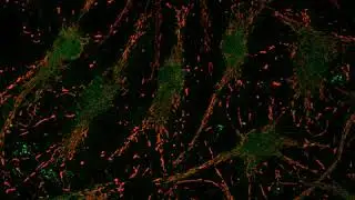Астроциты и нейроны (Конфокальная микроскопия) / Astrocytes and neurons (Confocal microscopy)