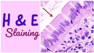 Hematoxylin and Eosin Staining |  Staining Technique in Histopathology#pathologyshortsAndsludes