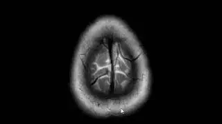 Whole body screening examinations at First Look MRI