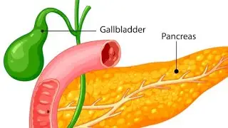 Post op update Gallbladder removal cholecystectomy 1/11/26
