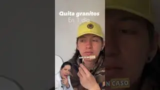REMEDIO CASERO PARA QUITAR GRANOS EN UN D&Iacute;A &iquest;FUNCIONA? Dermat&oacute;logo opina