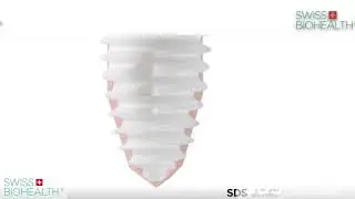 Tutorial Implantatsystem SDS1.1 und 2.0 Allgemein
