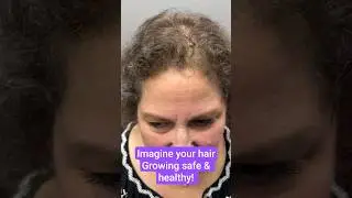 Imagine Hair Safe &Grows Freely| MicroStrand Only Hair Volume Method That Solves Every HairSituation
