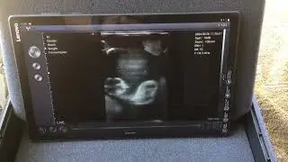Sonoptek EQ-1 Wireless Ultrasound Livestock Pregnancy Scanning Probe (Cow @ 4 Months)