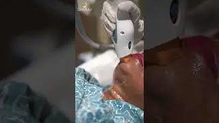 Non-Surgical Face Tightening with Thermage | Tamira Life | Chennai