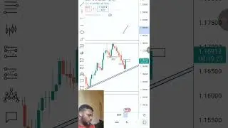 EURUSD Technical Market Update #forex #trading #currencytrading #tradesetup #forextrading