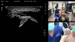 Dynamic US for MSK Pain and Neuropathic Pain