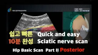 Hip Basic scan Part II Posterior, KAOM 강사 이근우, 친절한 초음파, 대한근골격계 초음파학회