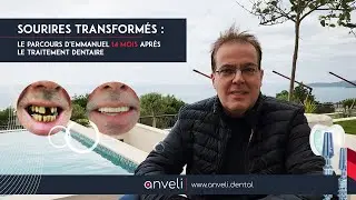 Sourires Transform&eacute;s : Le Parcours d'Emmanuel 14 Mois Apr&egrave;s le Traitement Dentaire