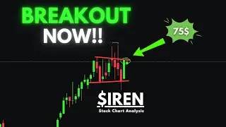 IREN Stock Analysis | BIG Money Steps In! | 2026 Price Target