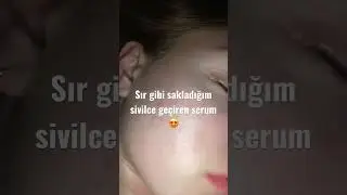 Sivilce problemi olan izlemeli🤩#sivilce #aknetedavisi #akne o serum yorumda 🫶