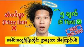 ဘယ်လောက် ပေါင်းတင်တင် ဆံပင်ဖွာတုန်းပဲလား? ဒါတွေလုပ်နေသရွေ့ ဆံပင်ဘယ်တော့မှ မကောင်းနိုင်ပါ
