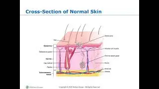 Skin Integrity and Wound Care chp 33 part 1
