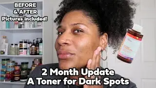 Good Molecules Toner: 2-Month Update and Honest Review for Dark Spots