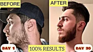100% RESULTS GUARANTEED To Grow Your BEARD FASTER Hacks For TEENGERS | Patchy Beard Problem Solution