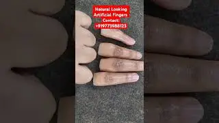 Natural Looking Artificial Fingers | Prosthetic Fingers in India | Silicone Fingers