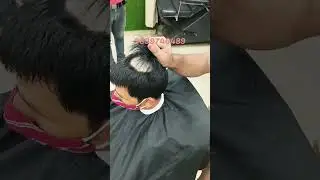 Best Amazing Crown Hair Patches wig for bald Men 👨&zwj;🦲| #shorts #viral #tiktok #trending #amazing