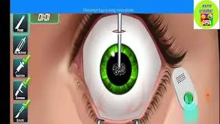 ASMR Iris Surgerybyasmr animation#asmrआंखों की पुतलों के लिए ASMR एनिमेशन द्वारा सर्जरी #ASMR #asmr