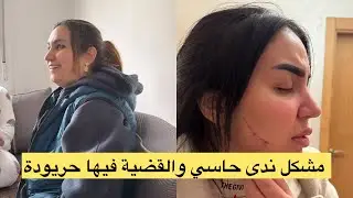 ندى حاسي .. حتى للوجه ملعبينش 