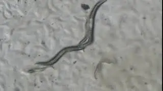 RNAi in C.elegans : pat-4